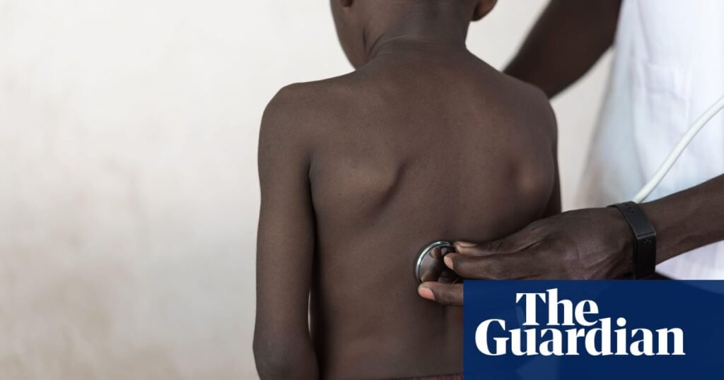 Millions of teenagers in Africa have undiagnosed asthma – Research | Global Expansion